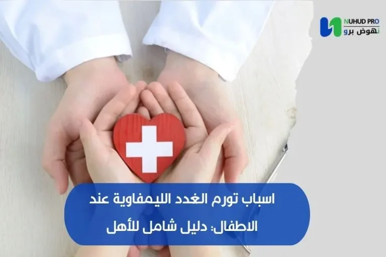 اسباب تورم الغدد الليمفاوية عند الاطفال