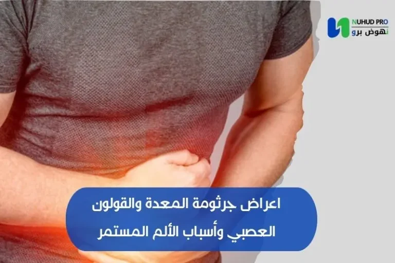 اعراض جرثومة المعدة والقولون العصبي